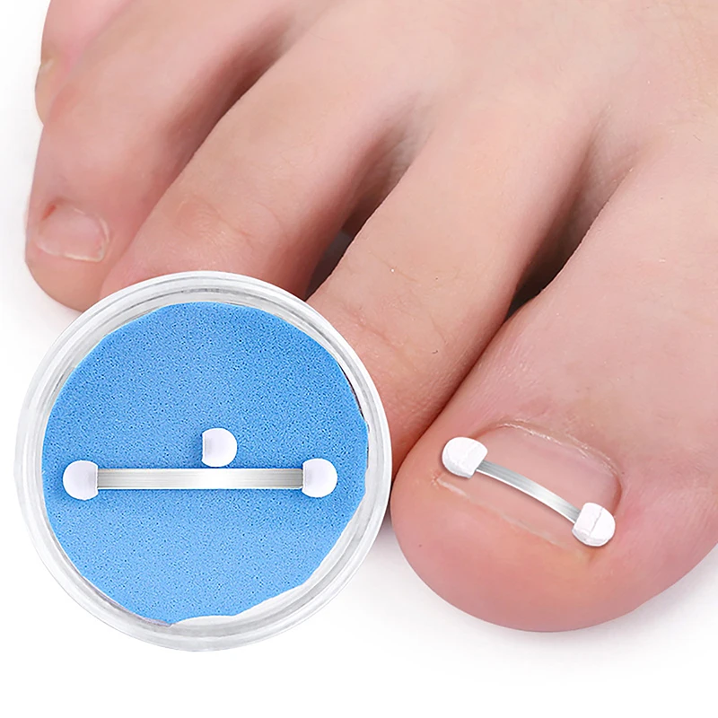 Corrector de uñas encarnadas, herramienta profesional para el cuidado de los pies, pedicura, tratamiento de uñas encarnadas