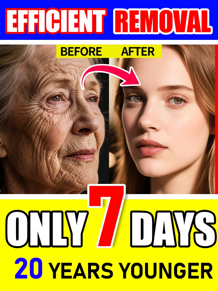 

Wrinkles improve to become beautiful now