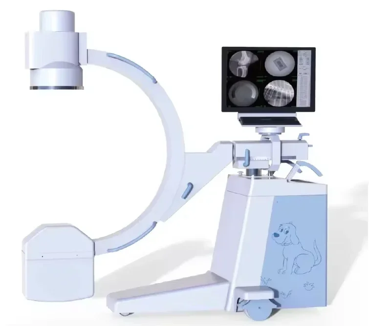 Professional Medical Equipment Supply High Frequency Digital Fluoroscopy C-Arm X Ray Machine with Top Quality X-ray Tube