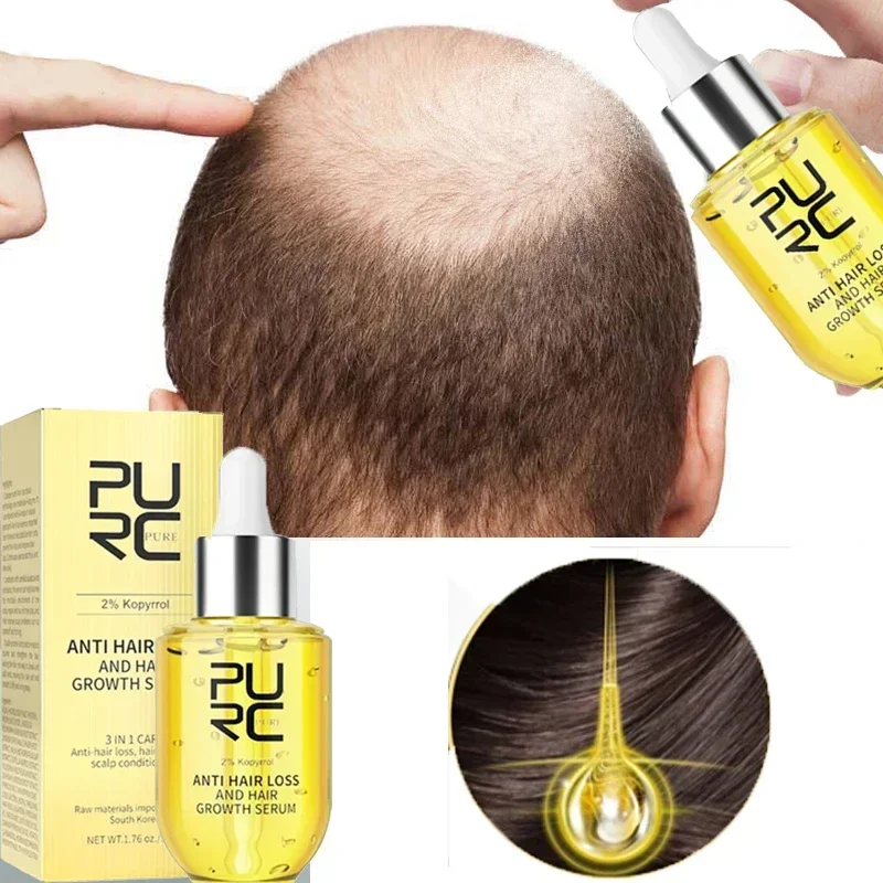 

PURC Fast Hair Growth for Men Women Ginger Grow Hair Oil Care Anti Hair Loss Scalp Treatment Serum Products Beauty Health 2023