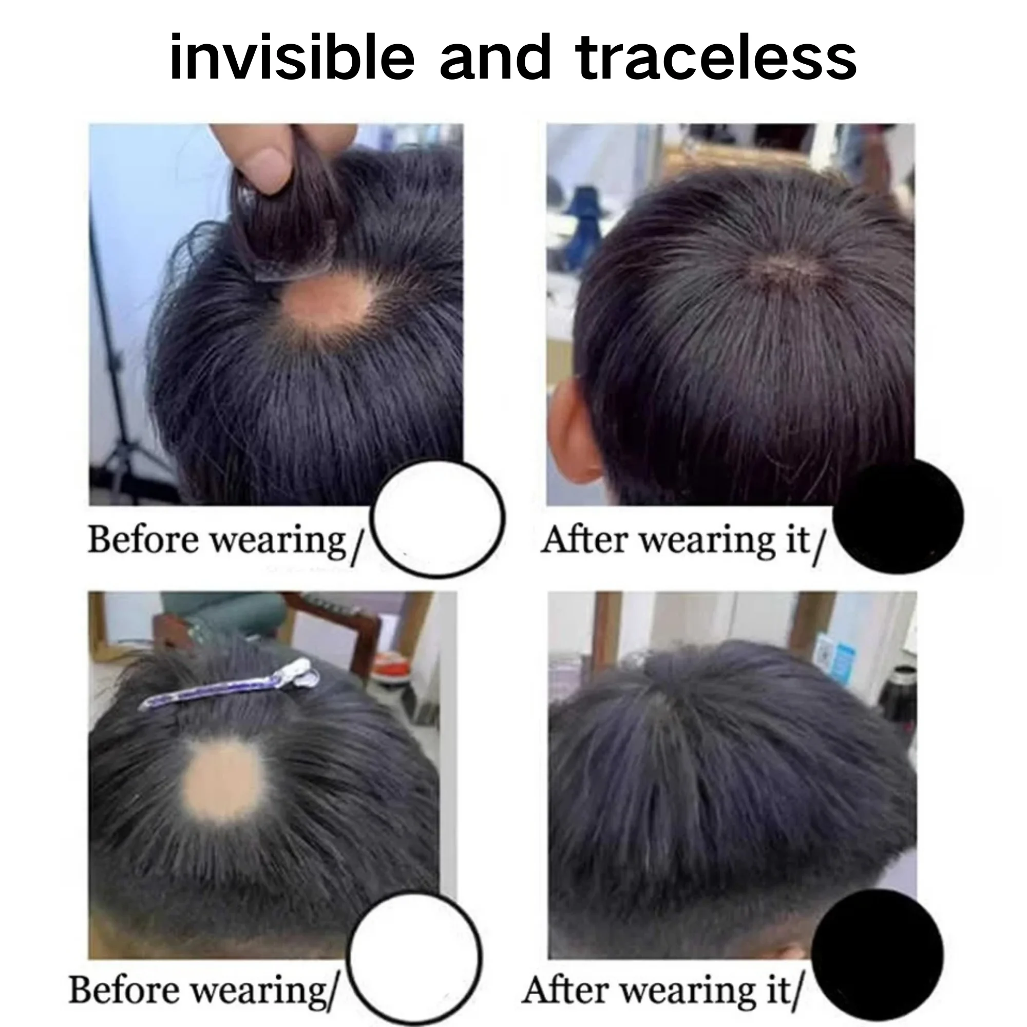 OCK 1 paar Menselijk Haar Vervanging Patch voor Mannen 15 cm Haarlijn Verlies Rechte Tape in Vervanging Toupetje