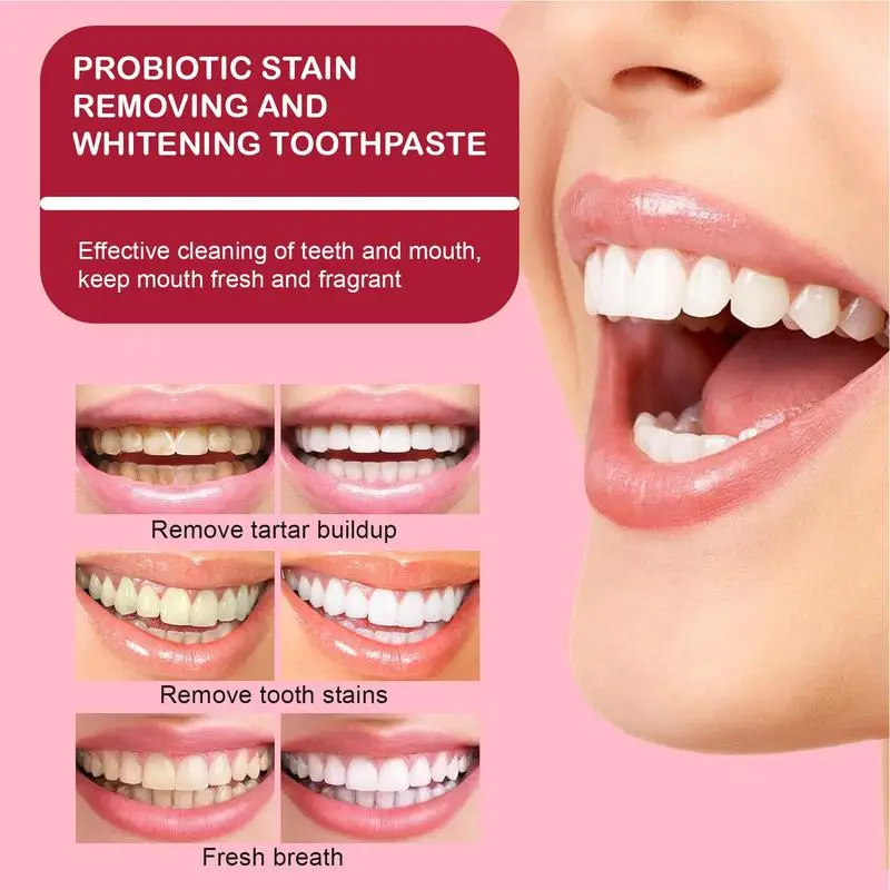 SP-4 Probiotic toothpaste for refreshing breath whitening teeth SP-4 toothpaste for removing Yellow Tooth Smoke Stains