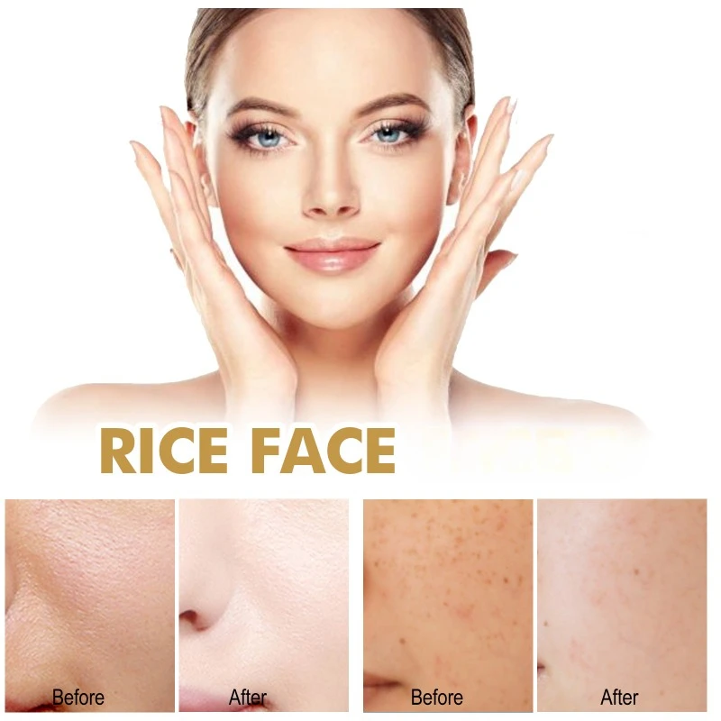 Crema facial de arroz que se desvanece, líneas finas, manchas oscuras, elimina la melanina opaca, ilumina la piel, hidrata profundamente los poros reafirmante, repara la cara