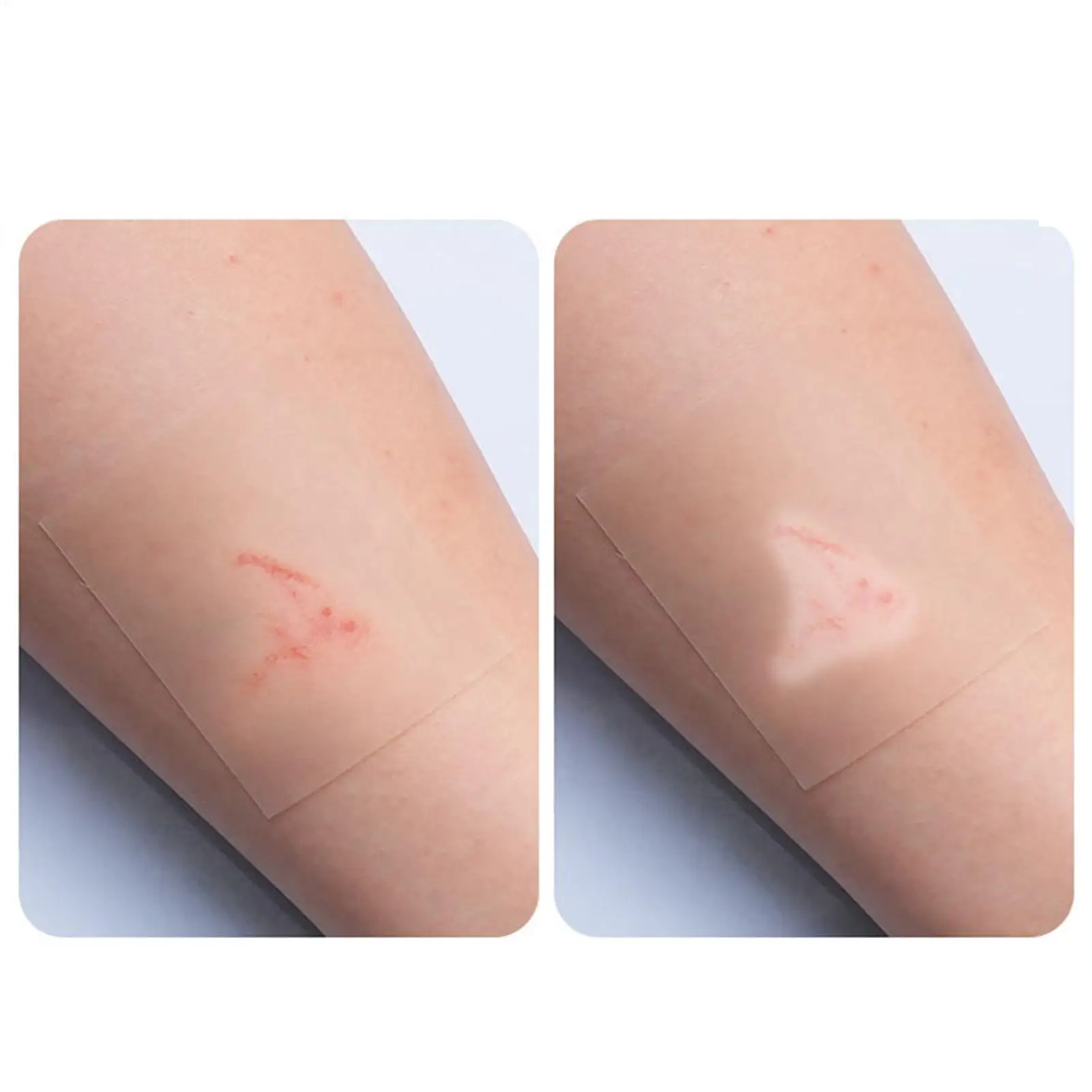 Rotolo idrocolloidale per la cura delle ferite Bende idrocolloidali con bende idrocolloidali doloranti da letto autoadesive