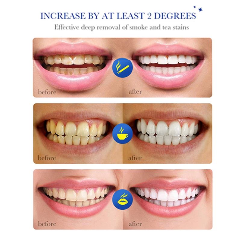 Teeth Whitening Toothpaste Fast Remove Smoke Coffee Tea Stains Fresh Breath Bleaching Dental Cleaning Oral Hygiene Plaque Tools