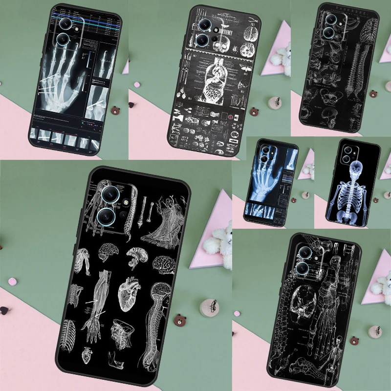 Radiological Human …