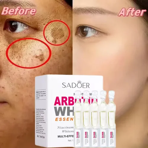 Nicotinamida blanqueamiento pecas suero facial eliminador de manchas oscuras productos eliminación Melasma melanina hidratante iluminar el cuidado de la piel