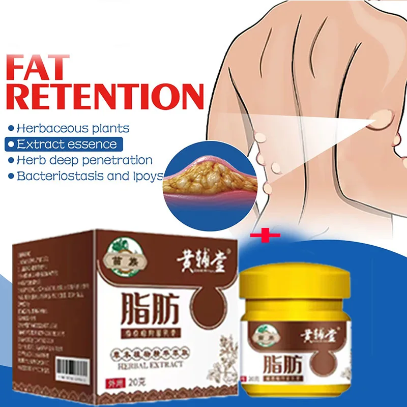 Lipoma Removal Cream Relief Swelling Fat Elimination Cream Remove Subcutaneous Lump Extract Care Fat Bulges Lump