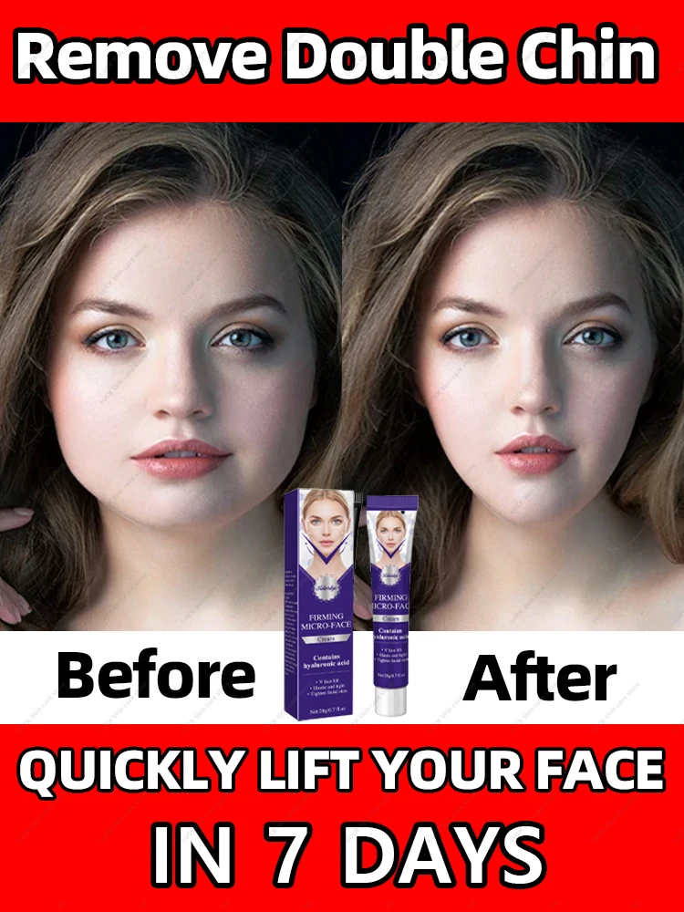 Double Chin Remove Face Slimming V Shape Firming lift