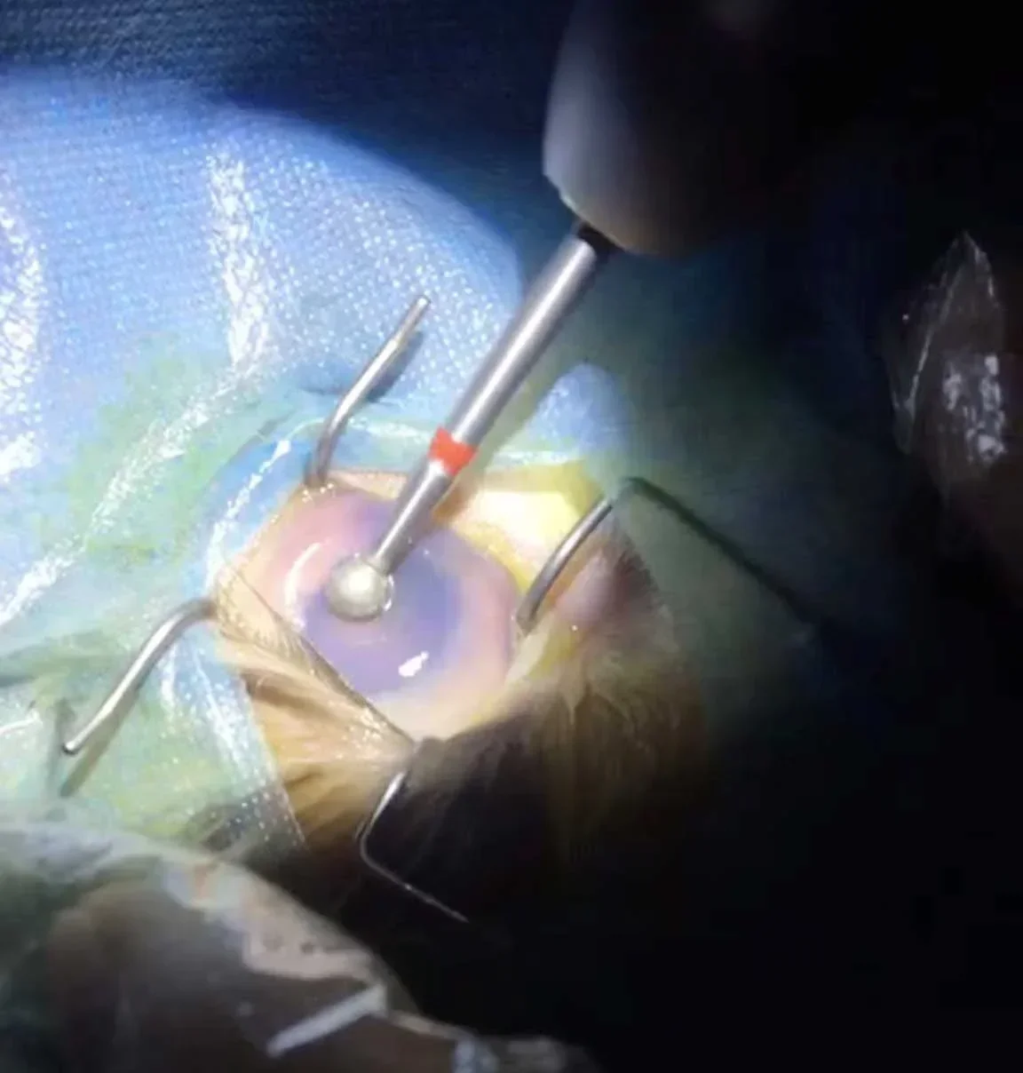 2025 Burr diamantata veterinaria Diametro 5,0 mm Chirurgia oculare Oftalmologia Strumento chirurgico oftalmico veterinario
