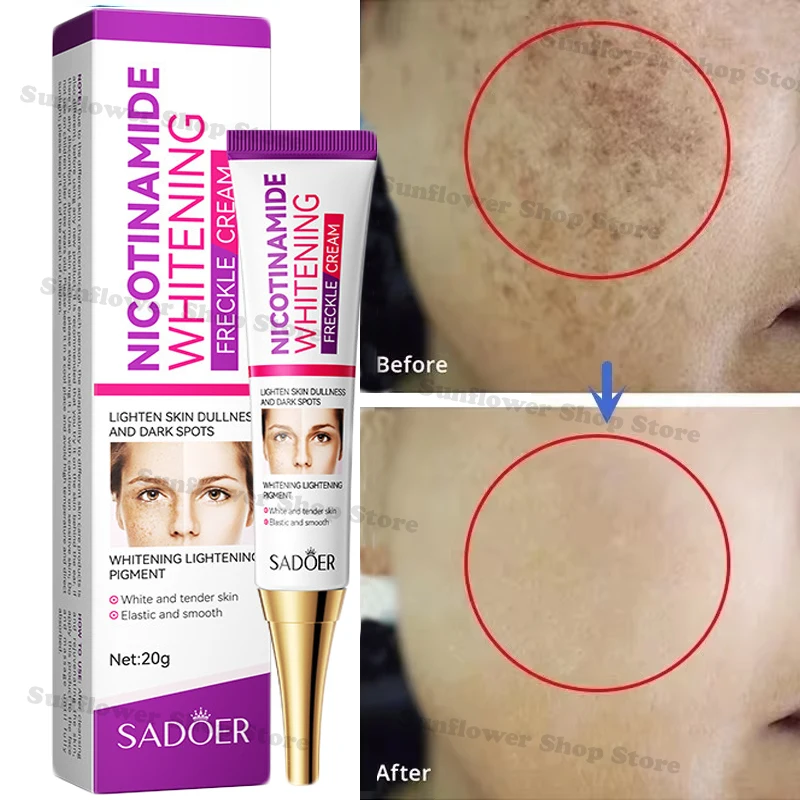 Whitening Freckle Cream Melasma Dark Spots Pigmentation Removal Products Fade Stain Melanin Repair Brighten Korean Skin Care