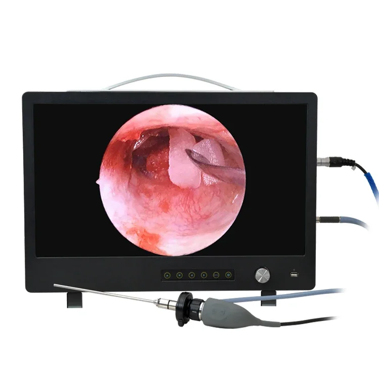 22 inch LCD Monitor Medical Portable Endoscope ENT Video Camera for Bronchoscope/Nasopharyngoscope / Cystoscope /Ureteroscope