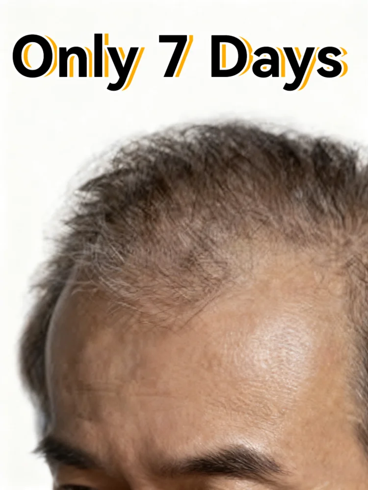 Baldness savior, easily restore your thick black hair, regain your confidence, and return to the peak of unemployment