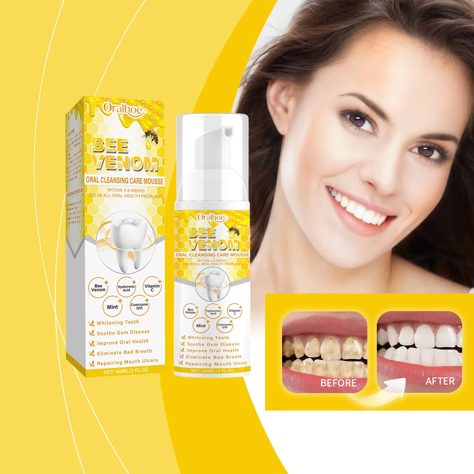 

Пенный мусс с пчелиным ядом, зубная паста, отбеливание зубов, удаление желтых пятен на зубах, чистка пятен на зубах, средство для ухода за полостью рта, свежий продукт для ухода за зубами