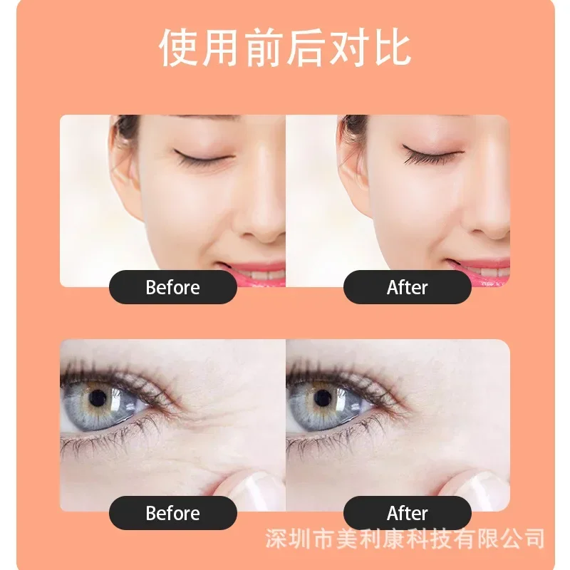 Tila Beauty Eye Device EMS Microcurrent Desalination Black Circle and Eye Bag Beauty Device Ultrasonic Home Eye Massage Device