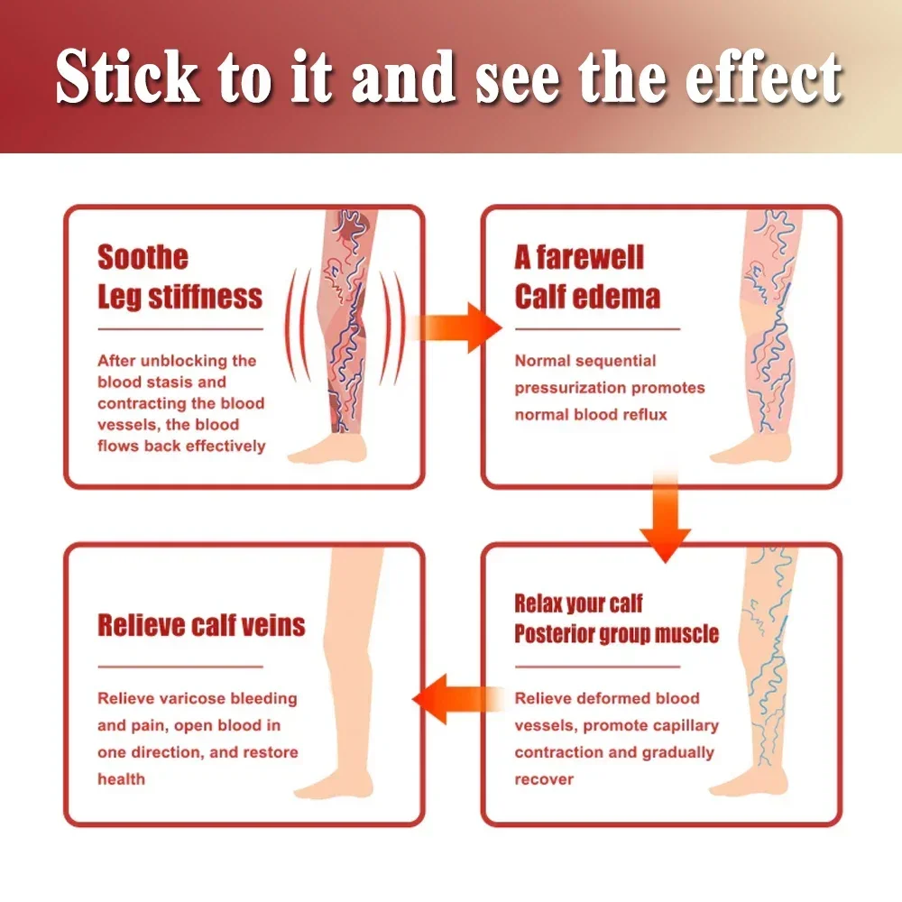 Эффективная наклейка для облегчения варикозного расширения вен, устранение сосудистой сетки, лечение флебита, успокаивающее средство для облегчения
