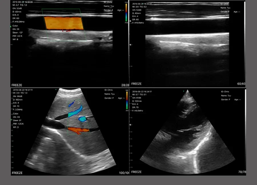 Handheld Linear Convex Phased Array 3 in 1 Double Probes WiFi Ultrasound Probe