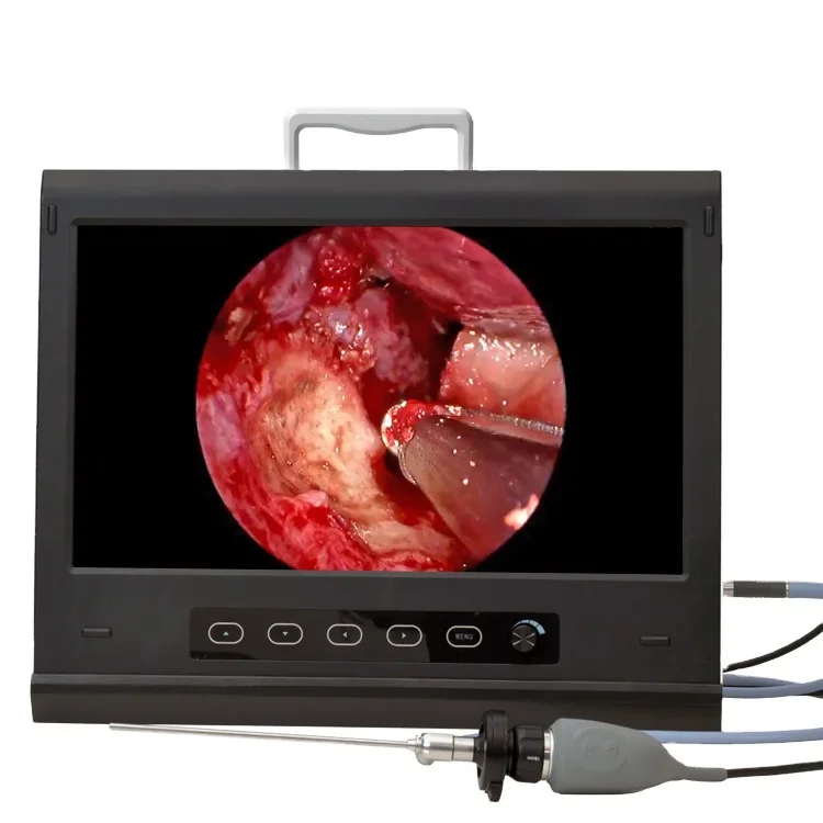 

Full HD good price medical integrated endoscope system USB endoscopy