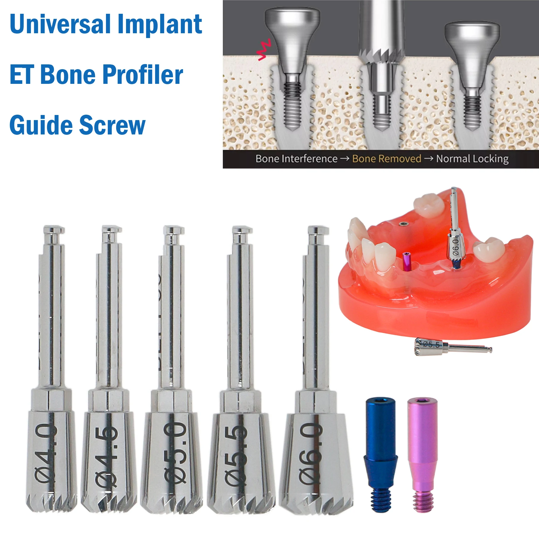 

Universal Implant Bone Profiler Drill Kit 4.0-6.0mm Bone Removal Drills with Guide Screws for Implant Surgery Prosthetic