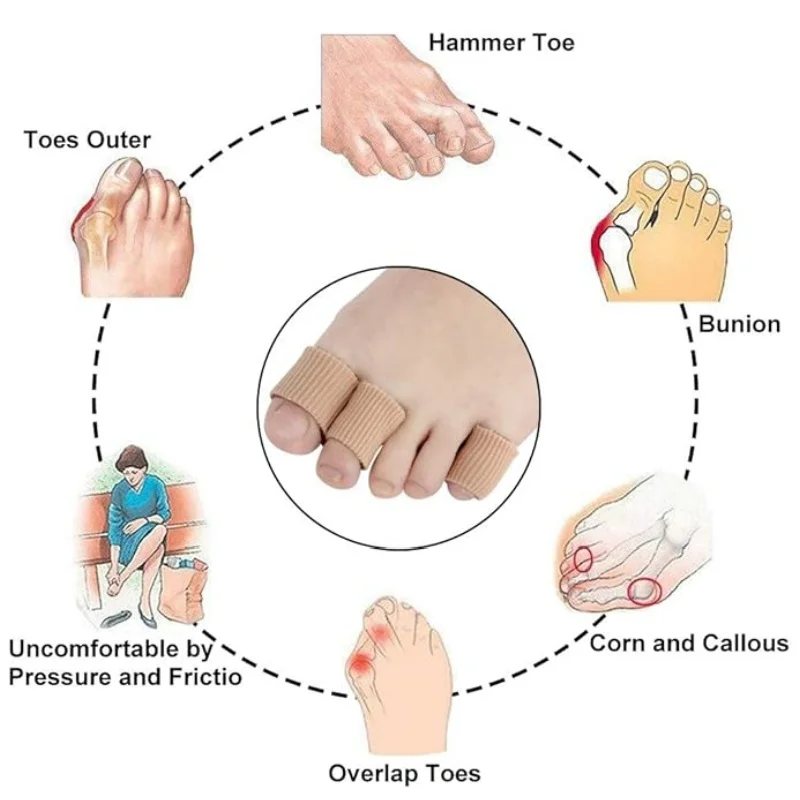 جل تو غطاء مرونة الألياف إصبع واقية أنبوب تو حماية الأنابيب تقليل الاحتكاك سيليكون حامي القدمين أجزاء العناية بالقدم