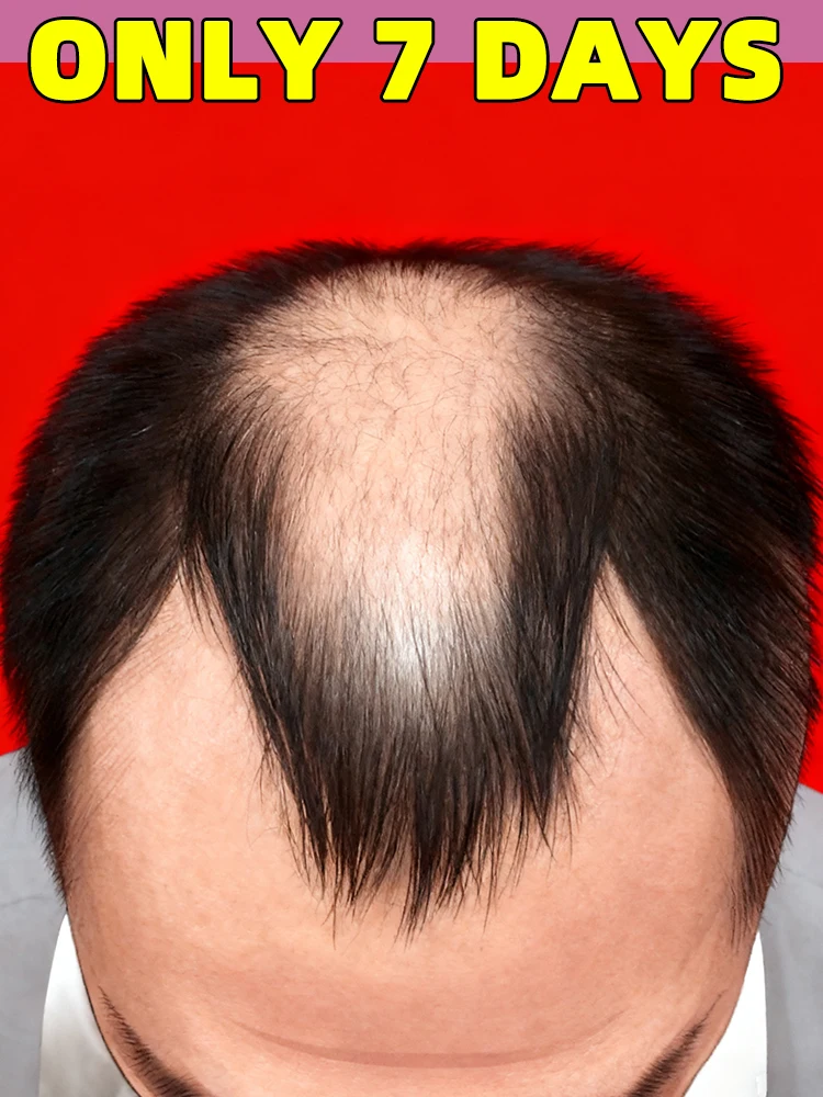 

Combination Set Meals Scalp Applicator Liquid Comb for Hair Scalp Treatment,Liquid Guiding Massager,Free shipping,unisex