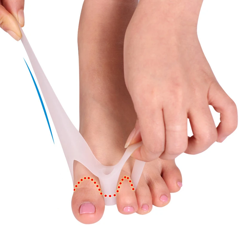 1/3/5PAIRS Silicone Gel Bunion Separator Corrects Hallux Valgus Eases Foot Pain High-quality Silicone In Demand