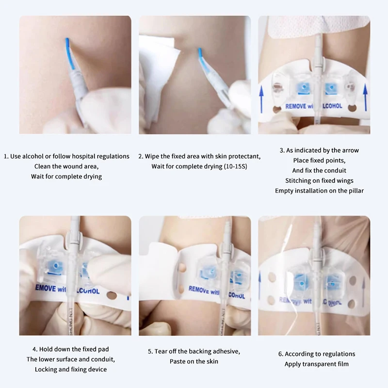 Urine Tube Fixation Universal Fixing Adjustable Design Sticker Holder Drainage Tube Device Nylon Bag Fixed