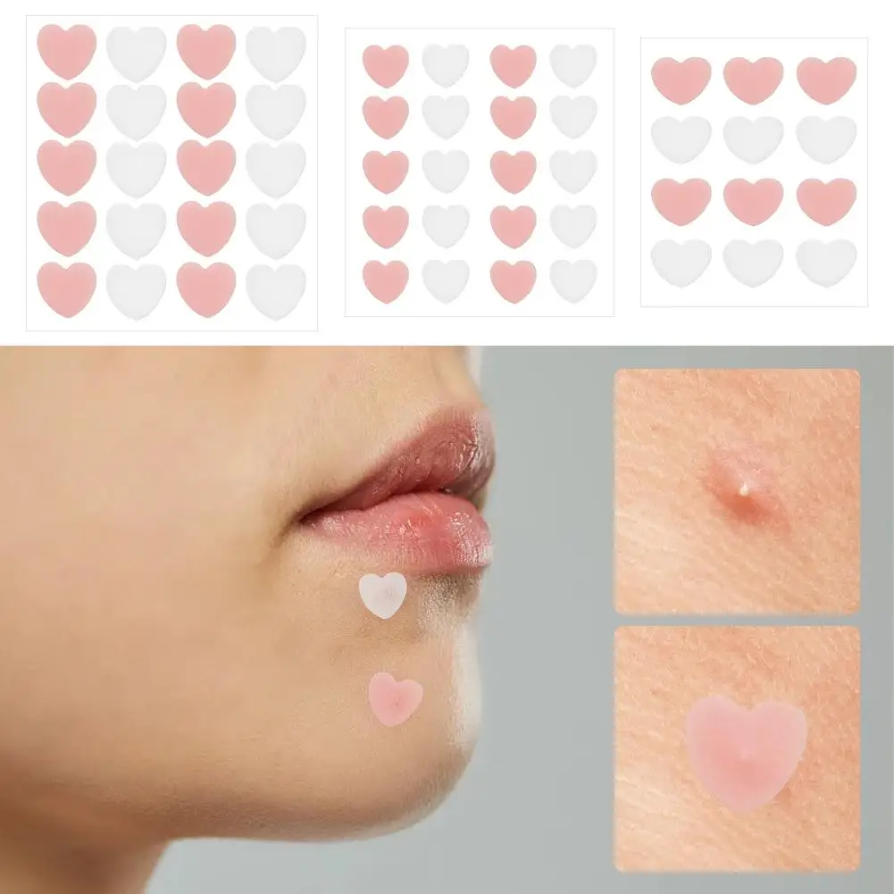 12/20PCS Star Pimple Acne Patches Acne Removal Skin Care Stickers Y2K Concealer Facial Spot Skin Care Beauty Makeup Tool