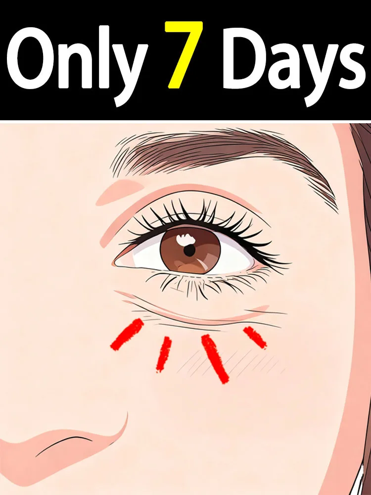 

Бесплатная доставка, паста Сделайте глаза не и удобно, против прощания и неисправностей.