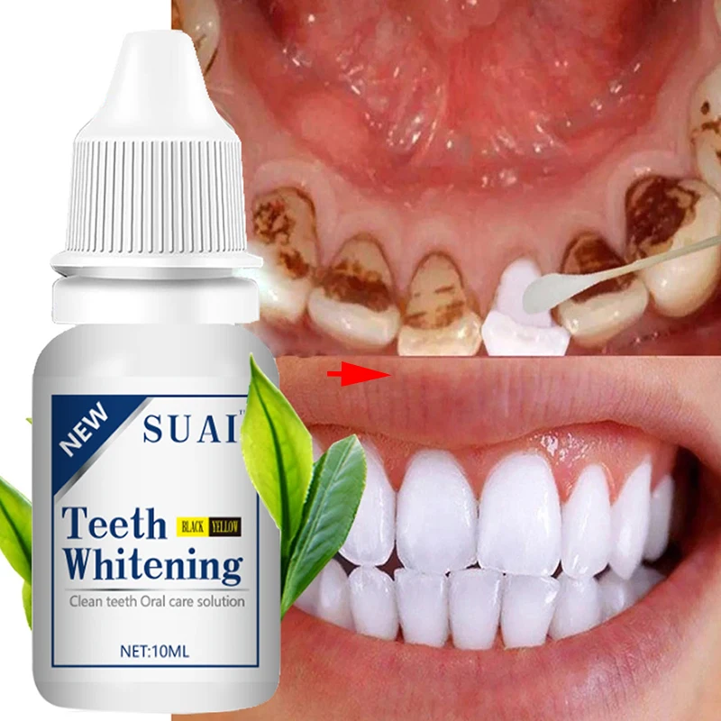 

Herbal Teeth Whitener Removes Smoky Stains Plaque Serum Brighten Clean Teeth Fresh Breath Repair Dents Dentistry Oral Care Tool