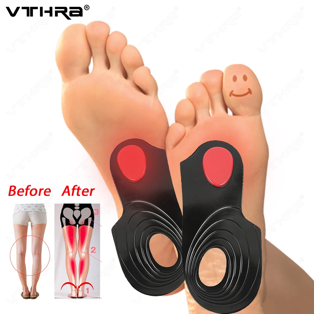 Orthopedic Insoles Arch Support Flat Foot O/X Legs Correction Insoles Orthoses Pads Massaging Shoe Insoles Foot Care Shoe Unisex