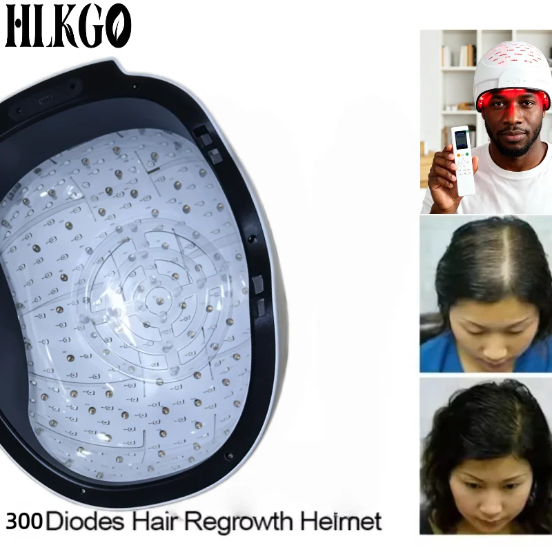 Dual Wave 650nm 660nm 6750mW Laser Cap, LLLT Hair Growth Helmet Therapy Device for Follicle Activation Regrowth