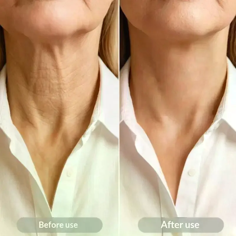 3/10pcs Neck Lifting Sticker Invisible And Skin Friendly PU Film Waterproof And Breathable Neck Lifting Sticker Neck Stripe Sti
