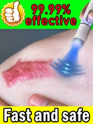 Laser Scar Repair Hot Sale