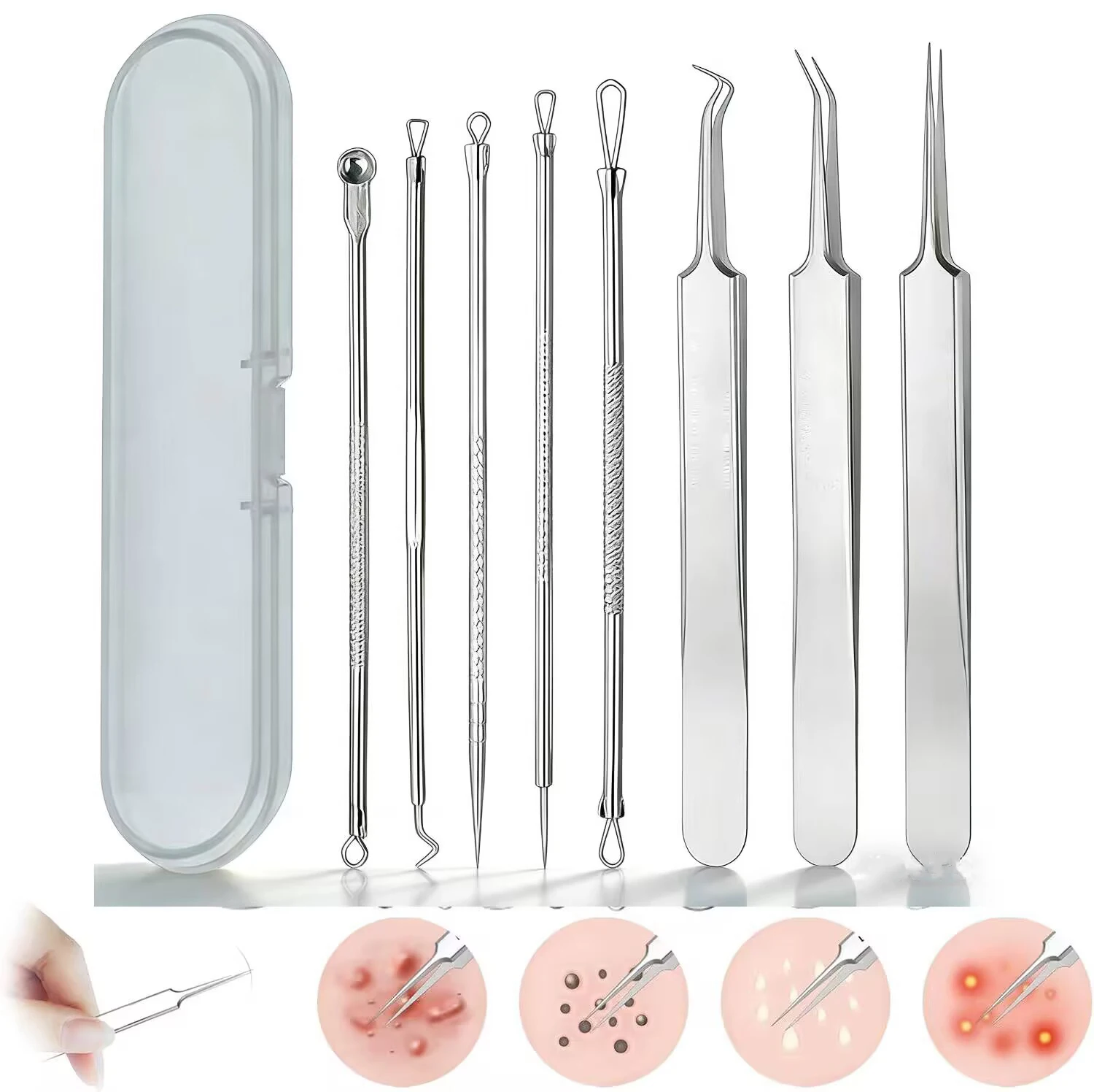 プロ仕様の8ピースステンレス製黒ずみ除去キット、精密ピンセット、白ニキビ、ニキビに優しい。