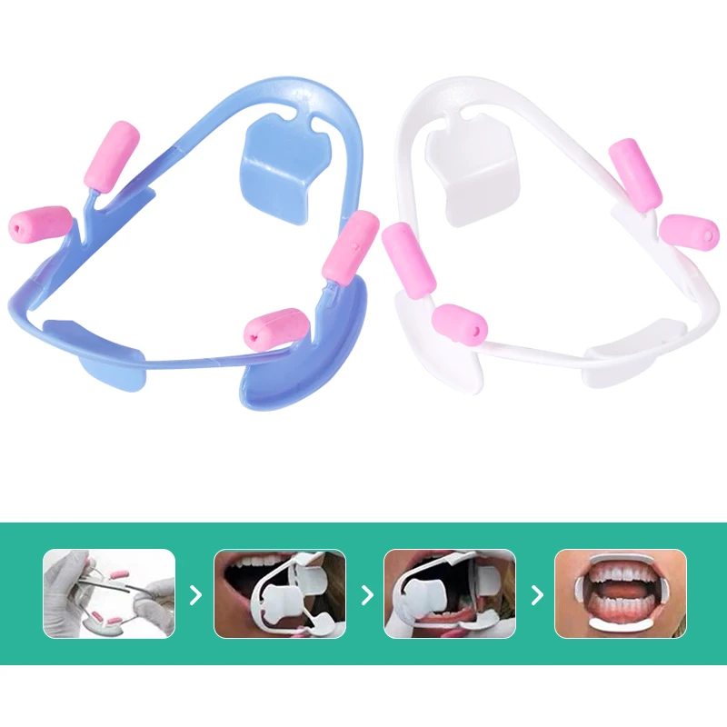 

3D Oral Mouth Opener Dental Lip Retractor Orthodontic Professional Dentist Tools Dentistry Materials