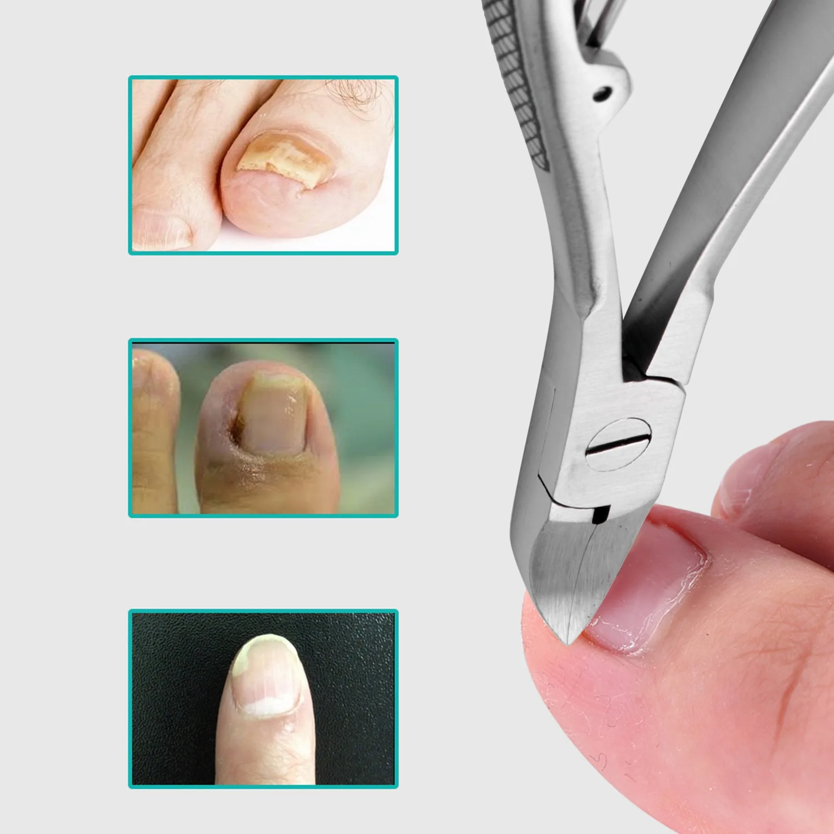 Profissional Toe Nail Clippers, Paronychia Nippers, Profissional Feet Trimmer, Ferramentas de cuidados com os pés inoxidáveis, Chiropody Podatry Cutters