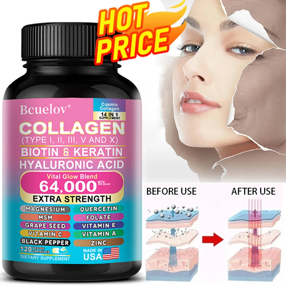 Collagen Peptides Types I, II, III, V & X, Biotin Keratin Hyaluronic Acid MSM Vitamins - Skin, Nails & Joint Health, Anti-Aging