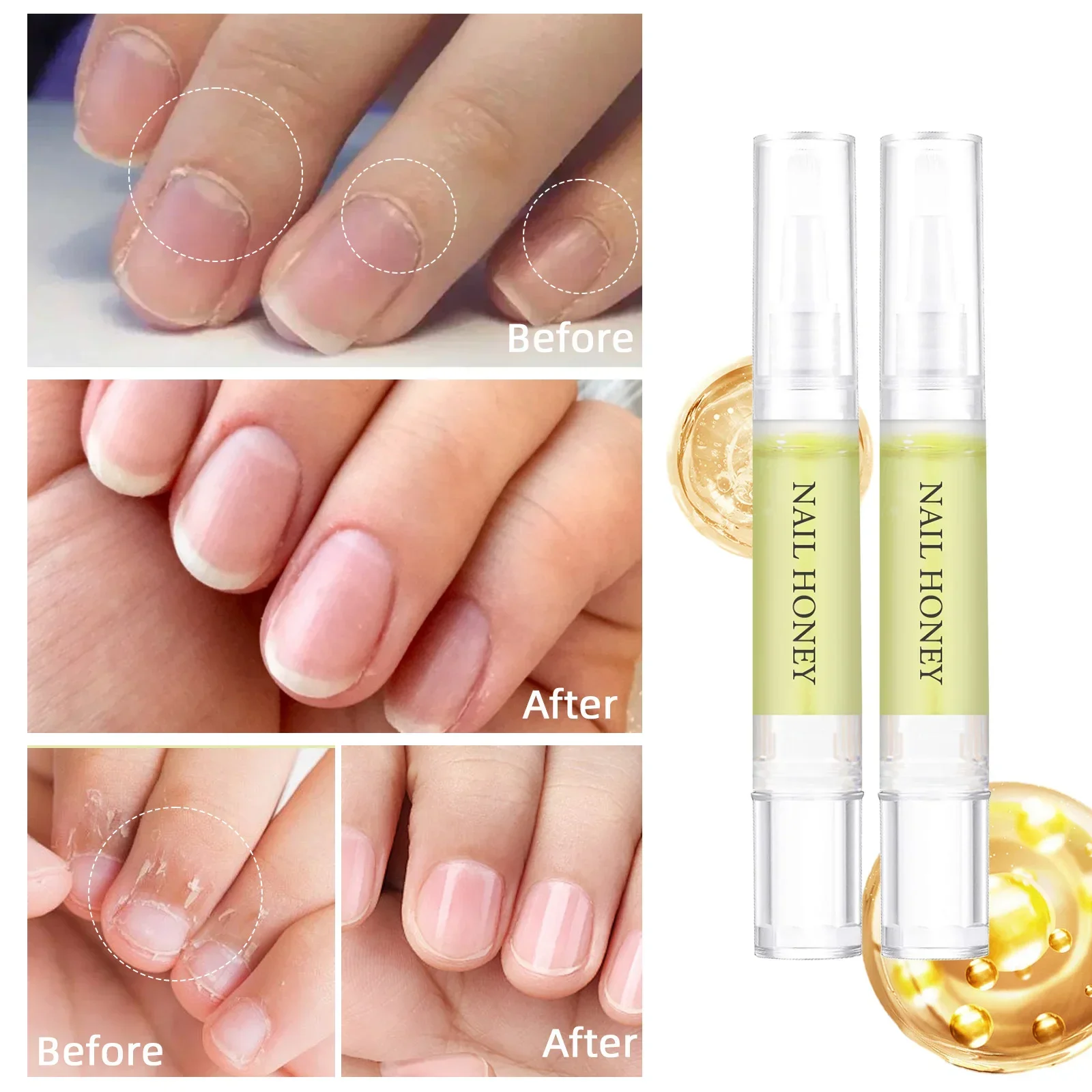 قلم زيت تغذية الأظافر تليين حماية البشرة منع Agnail جيل للأظافر البولندية علاج الأظافر إهاب تنشيط قلم زيت تغذي
