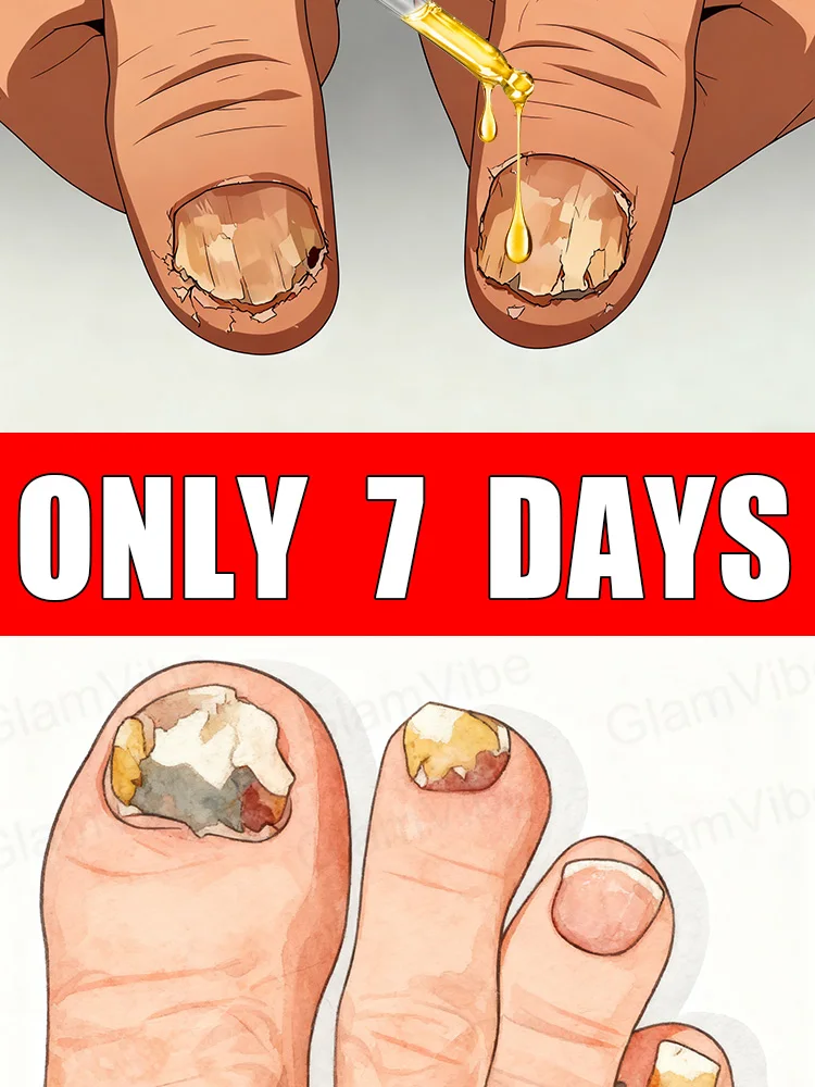 

Qᴜɪᴄᴋ Tʀᴇᴀᴛᴍᴇɴᴛ, Sᴀʏ Gᴏᴏᴅʙʏᴇ ᴛᴏ Fᴜɴɢᴀʟ Nᴀɪʟ Wᴏʀʀɪᴇs