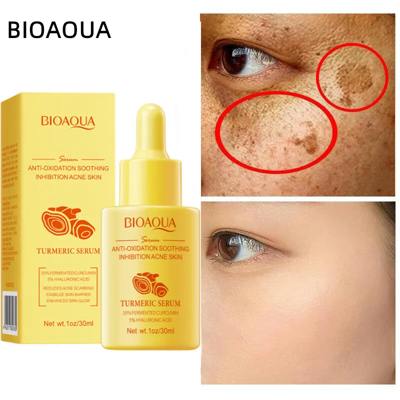 

Turmeric Whitening Freckles Serum Remove Dark Spots Melasma Brighten Lighten Melanin Improve Dull Anti-aging Face Skin Care 30ml