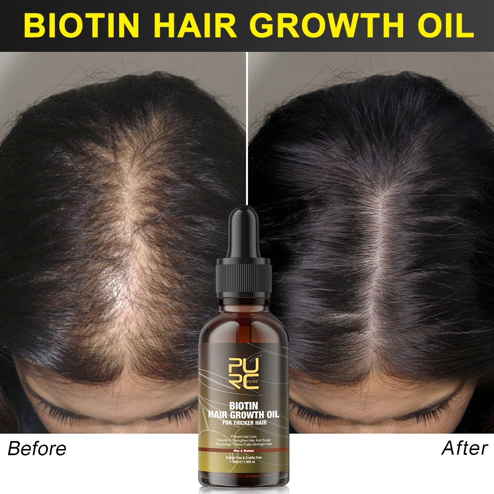 

PURC Biotin Hair Oil Products for Men Women Thickener Treatment Ginger Fast Thicken Hair Spray Hair Care