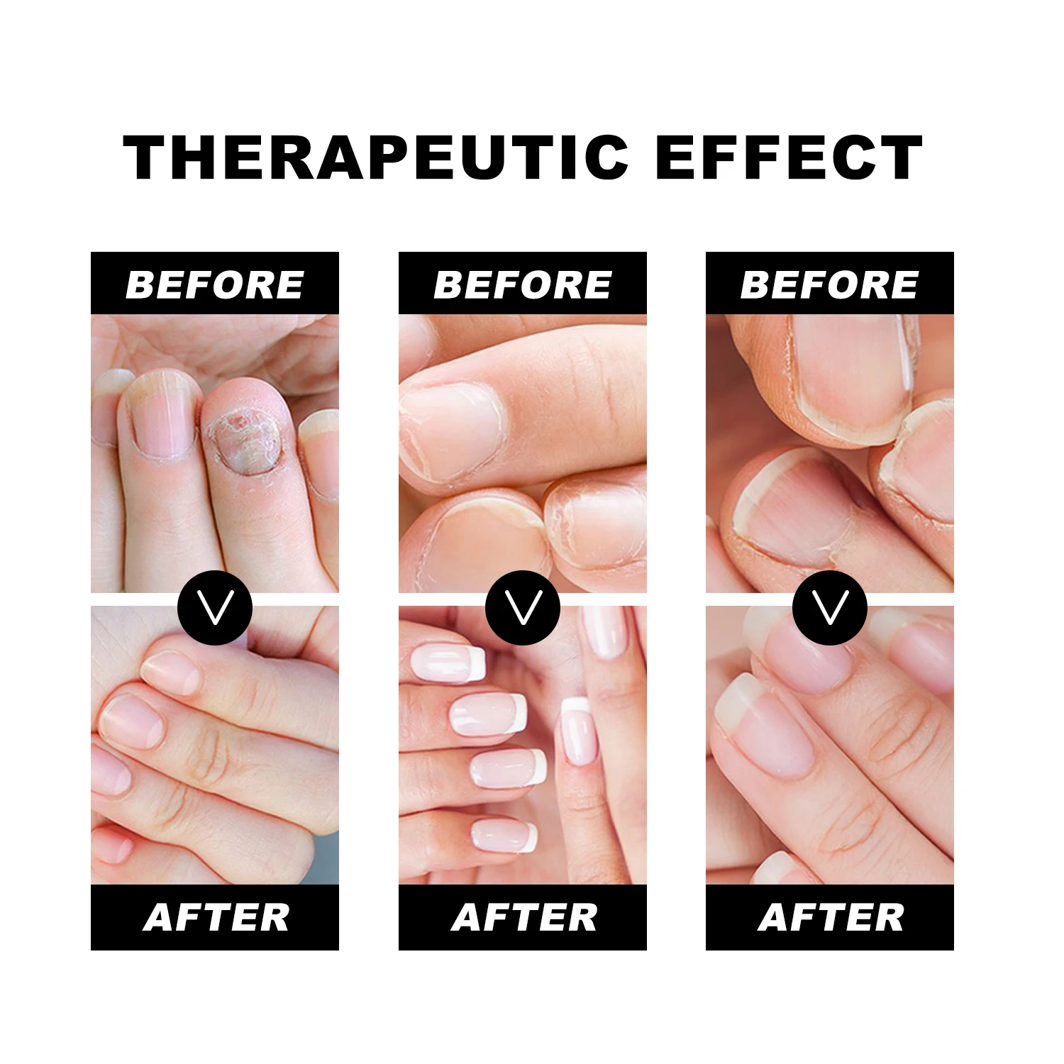 20 ml Nail Serum Nail Treatment Cleaning Nail Care Produce Cleaner Nail Art Manicureed Tool