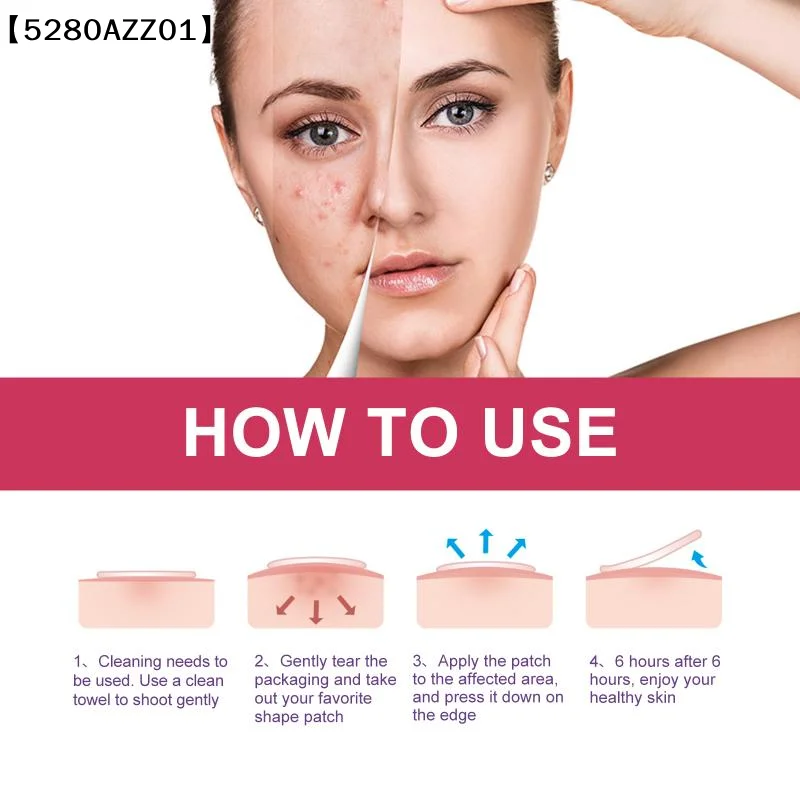 144 PCS/SET Star Pimple Patch Acne Colorful Invisible Acne Removal Skin Care Stickers Concealer Face Spot Beauty  Tools〔HMA58〕