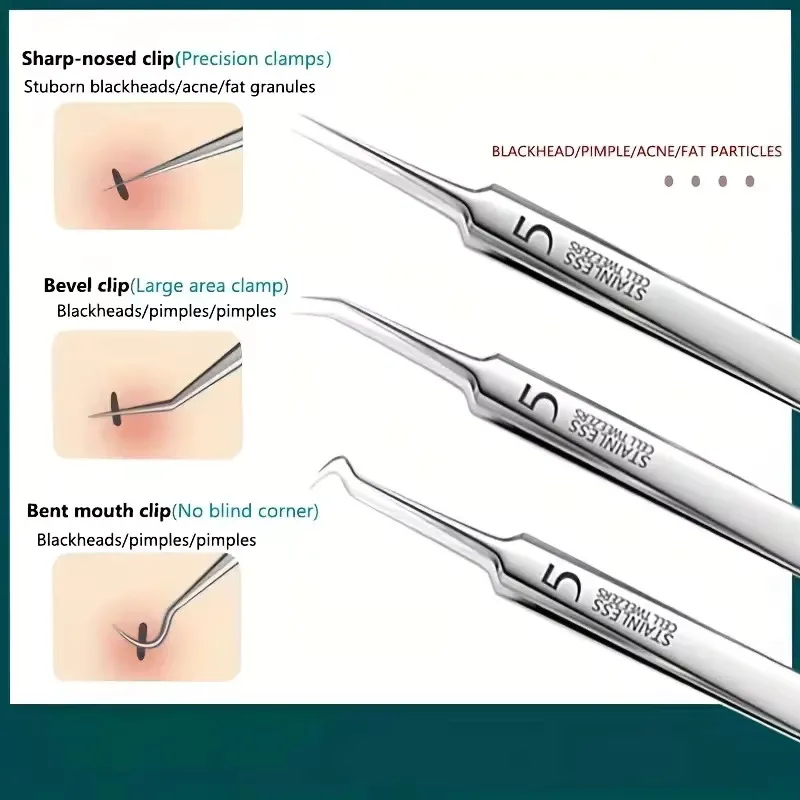 Pince à épiler Ultra-fine, extracteur de points noirs, aiguille d'acné, nettoyeur du visage, outil de soins de la peau