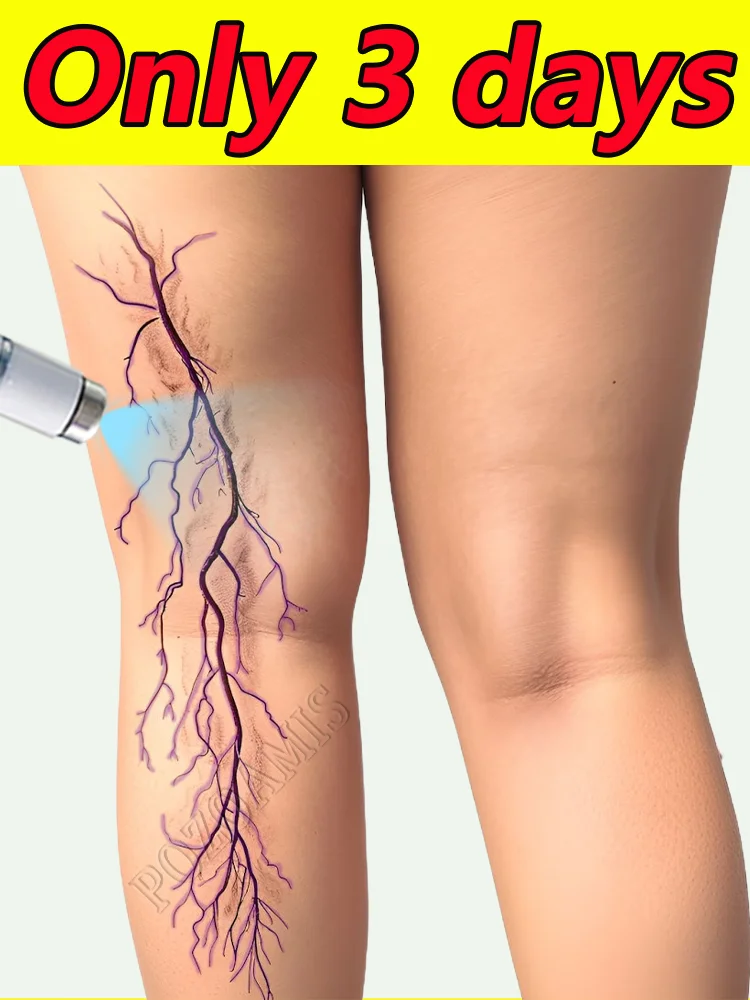 

Intravenous blue light therapy device, more discounts on sets