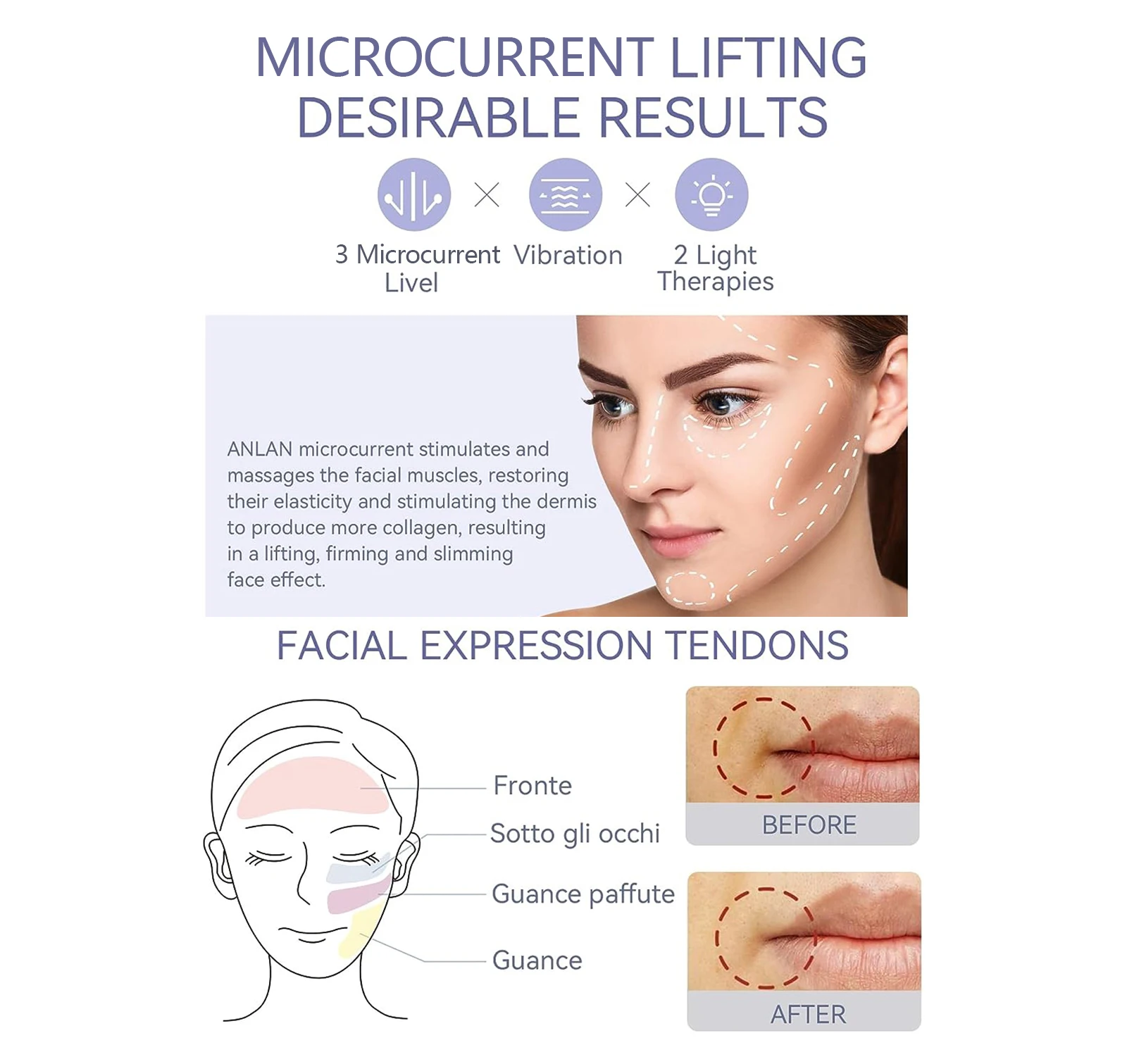 ANLAN 6-in-1 Facial Massager — Microcurrent Lifting & LED Beauty Device by Cozest S5f91c2bd904e48f18a956f0ccd5e3d4b3