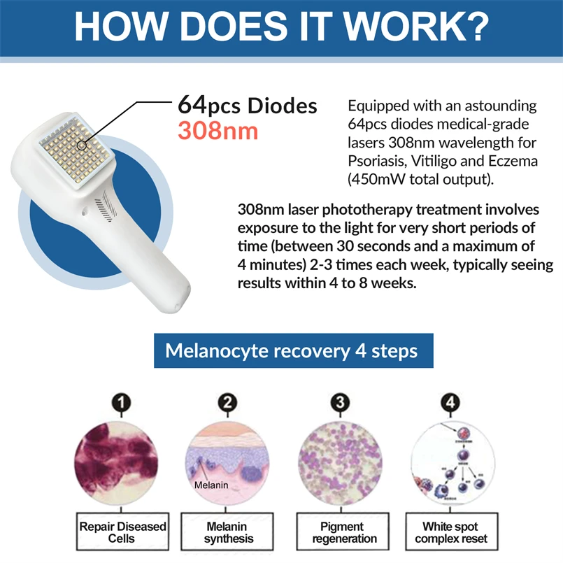 Medical Grade Treatment UV Lamp LED Effective to Treat Vitiligo Psoriasis Treatment Light Therapy for Dermatitis White Spot