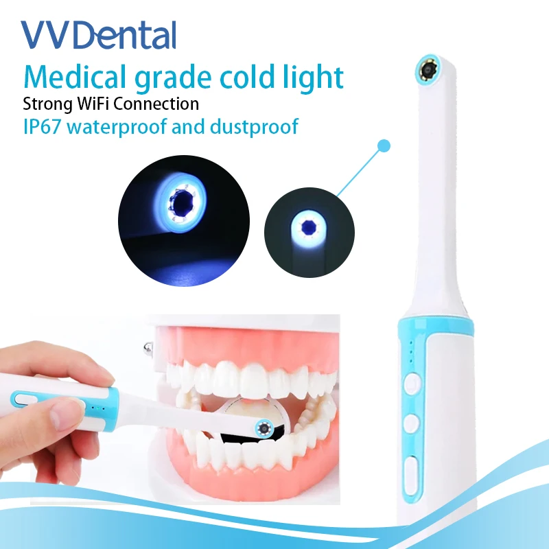 Dental specific intraoral molding high-definition endoscope portable household intraoral endoscope wireless WiFi visual camera