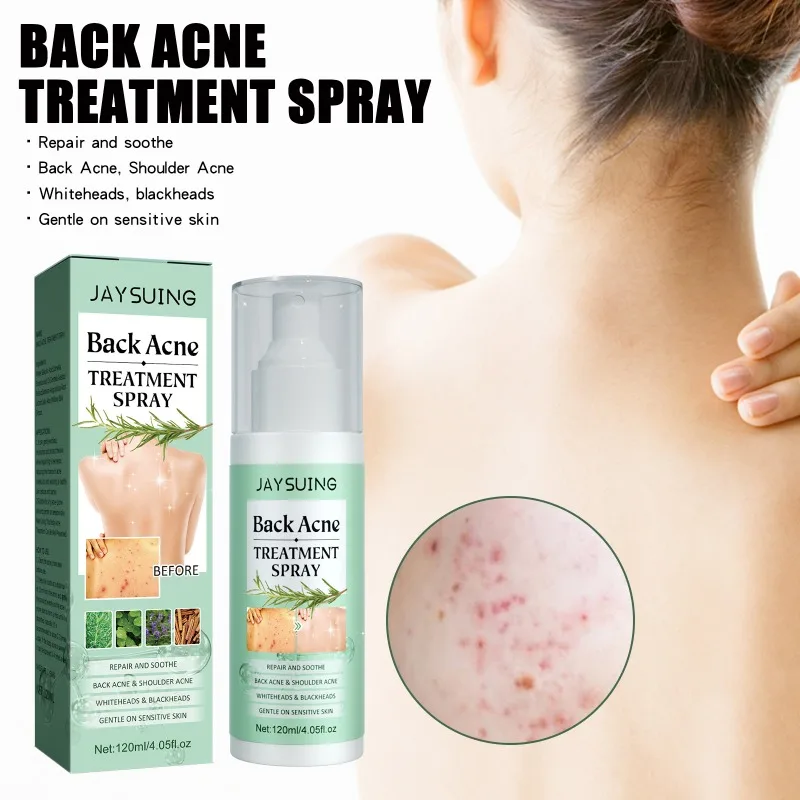 Back Acne Treatment Spray Moisturizing Repair Sooth Remove Whiteheads Blackheads Oil Control Shoulder Body Pimples Remover Spray